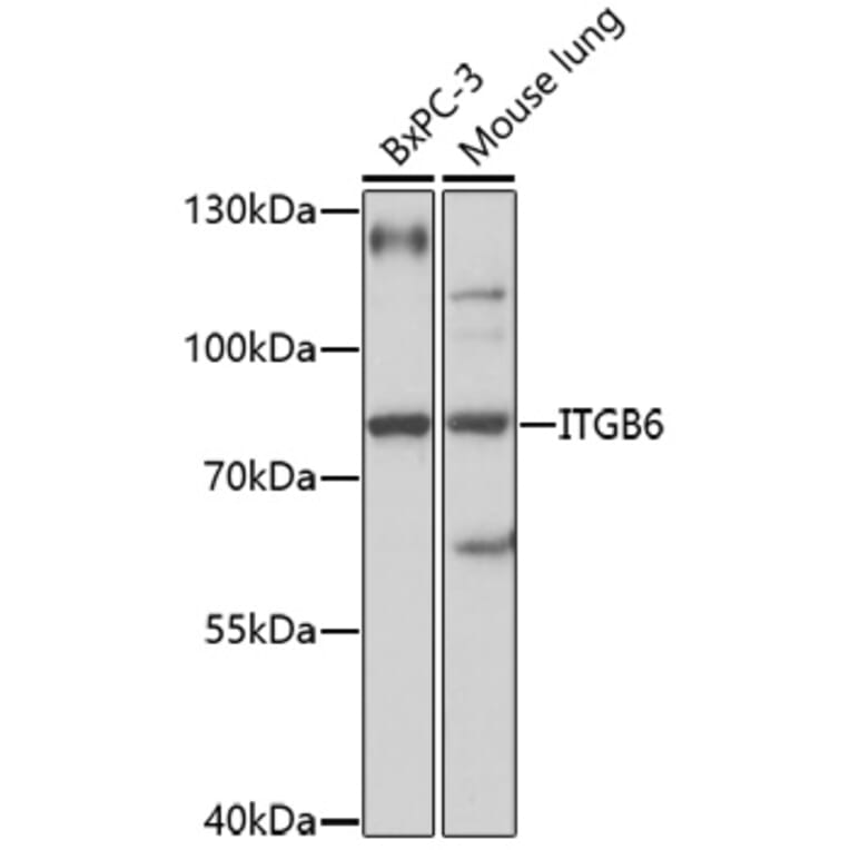 Western Blot - Anti-ITGB6 Antibody (A92620) - Antibodies.com