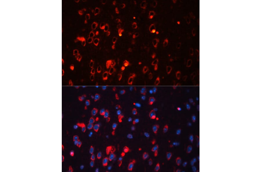 Immunofluorescence - Anti-Kv1.1 potassium channel Antibody (A92621) - Antibodies.com