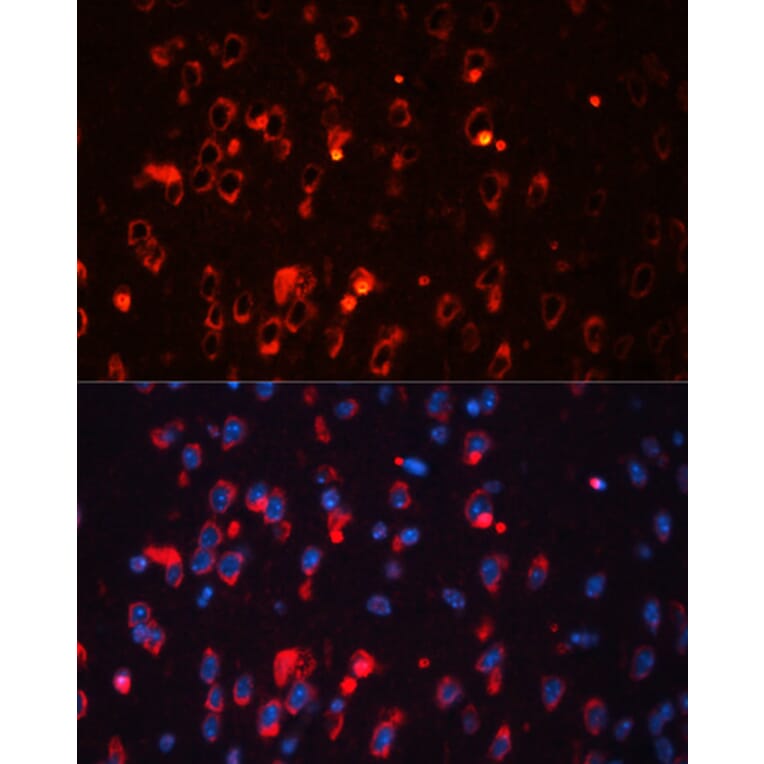 Immunofluorescence - Anti-Kv1.1 potassium channel Antibody (A92621) - Antibodies.com