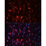 Immunofluorescence - Anti-Kv1.1 potassium channel Antibody (A92621) - Antibodies.com