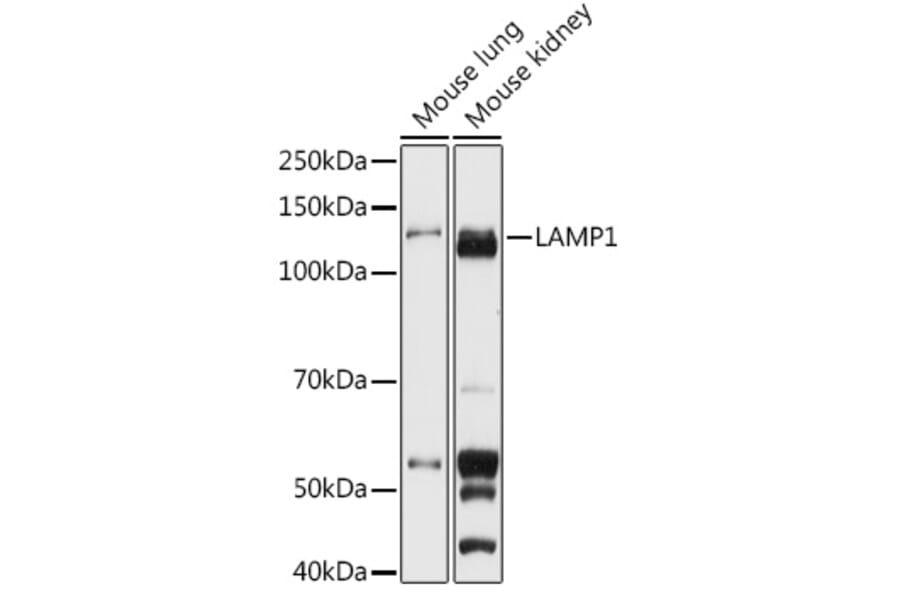 Western Blot - Anti-LAMP1 Antibody (A92624) - Antibodies.com