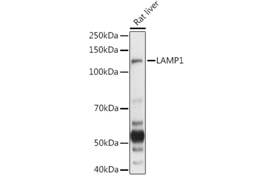 Western Blot - Anti-LAMP1 Antibody (A92624) - Antibodies.com