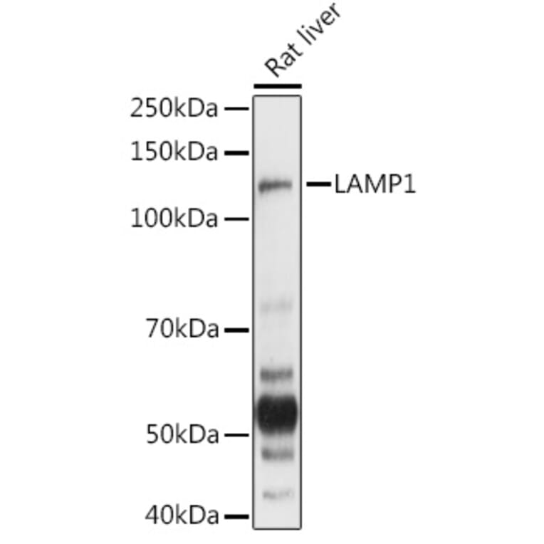 Western Blot - Anti-LAMP1 Antibody (A92624) - Antibodies.com