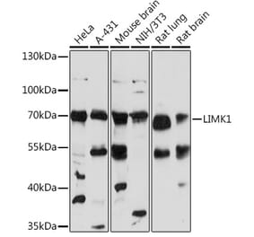 Western Blot - Anti-LIM Kinase 1 Antibody (A92626) - Antibodies.com