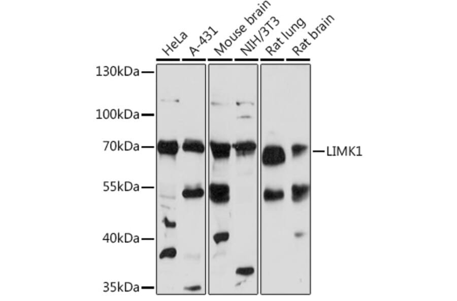 Western Blot - Anti-LIM Kinase 1 Antibody (A92626) - Antibodies.com
