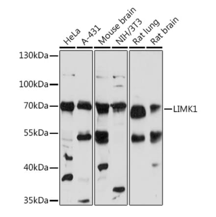 Western Blot - Anti-LIM Kinase 1 Antibody (A92626) - Antibodies.com