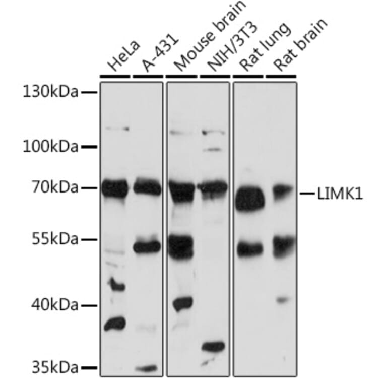 Western Blot - Anti-LIM Kinase 1 Antibody (A92626) - Antibodies.com