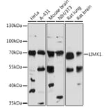 Western Blot - Anti-LIM Kinase 1 Antibody (A92626) - Antibodies.com