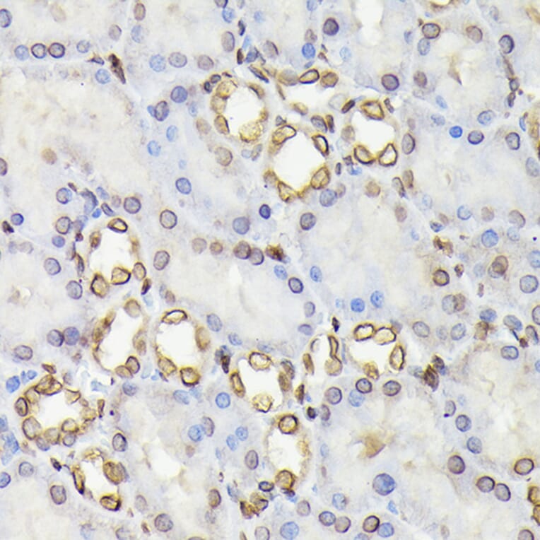 Immunohistochemistry - Anti-Lamin B1 Antibody (A92627) - Antibodies.com