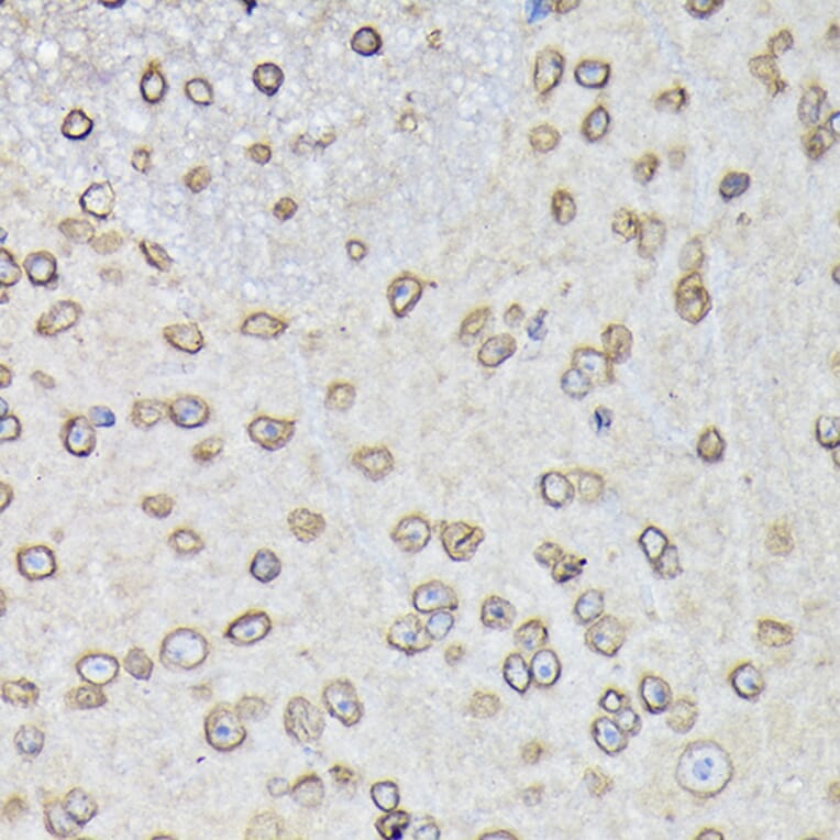 Immunohistochemistry - Anti-Lamin B1 Antibody (A92627) - Antibodies.com