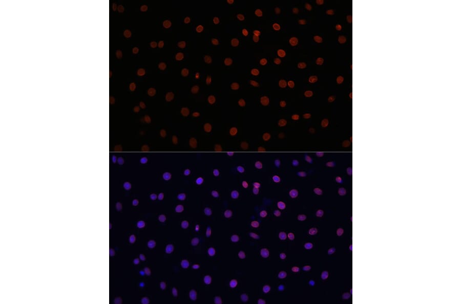 Immunofluorescence - Anti-Lamin B1 Antibody (A92627) - Antibodies.com