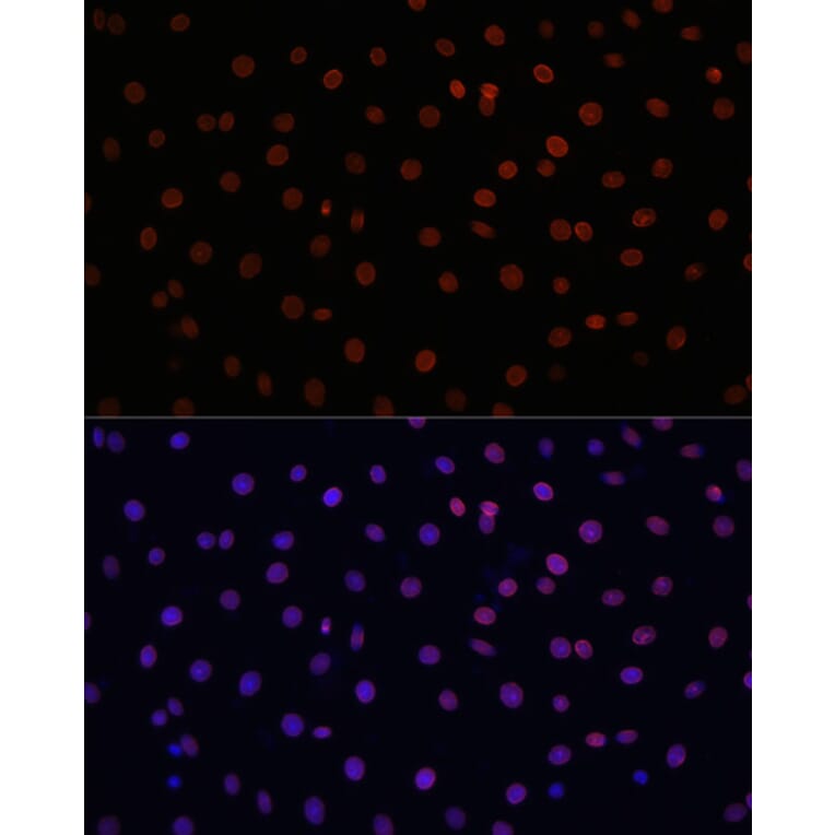 Immunofluorescence - Anti-Lamin B1 Antibody (A92627) - Antibodies.com