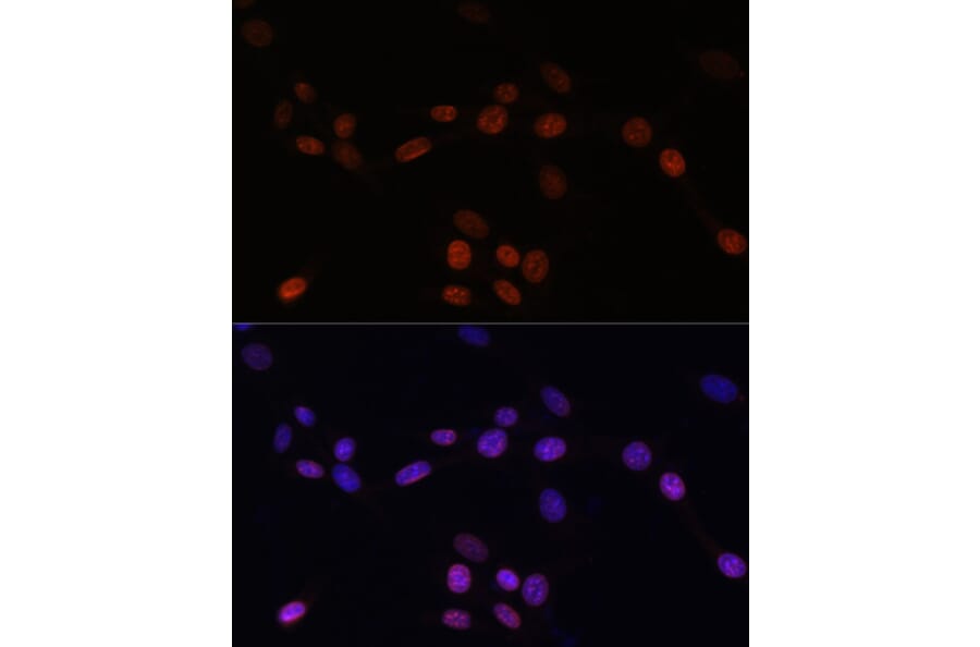 Immunofluorescence - Anti-Lamin B1 Antibody (A92627) - Antibodies.com