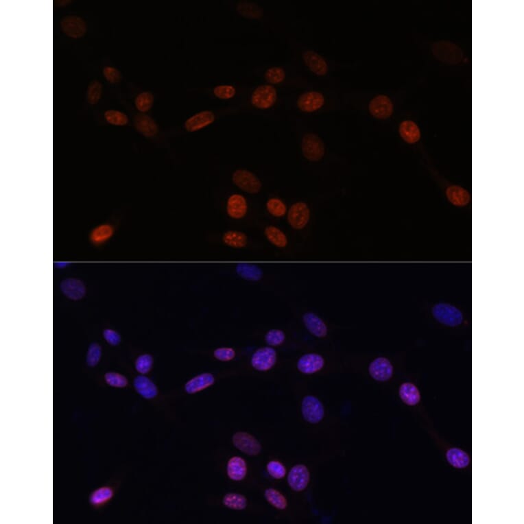 Immunofluorescence - Anti-Lamin B1 Antibody (A92627) - Antibodies.com