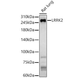 Western Blot - Anti-LRRK2 Antibody (A92628) - Antibodies.com