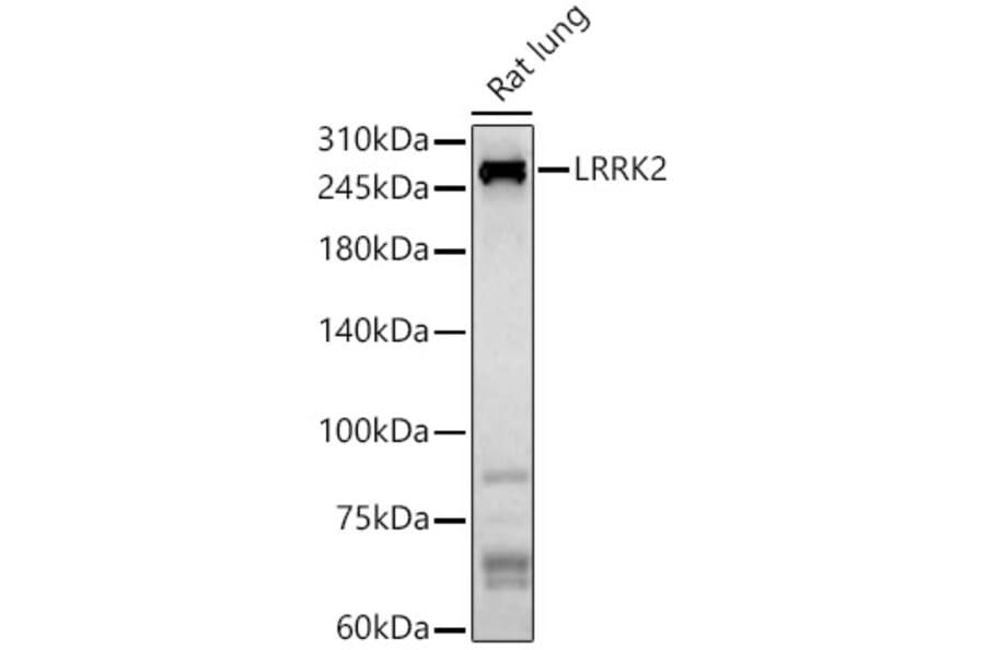 Western Blot - Anti-LRRK2 Antibody (A92628) - Antibodies.com