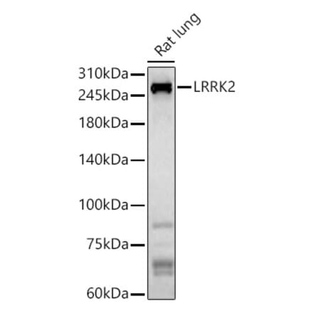 Western Blot - Anti-LRRK2 Antibody (A92628) - Antibodies.com