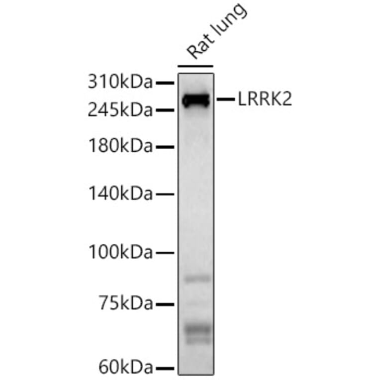 Western Blot - Anti-LRRK2 Antibody (A92628) - Antibodies.com