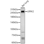 Western Blot - Anti-LRRK2 Antibody (A92628) - Antibodies.com