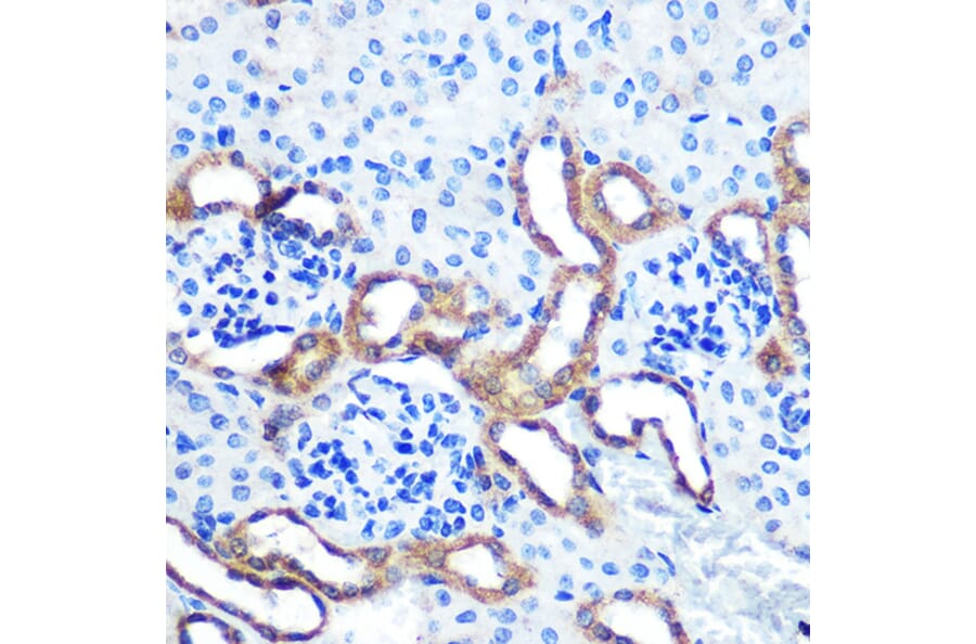 Immunohistochemistry - Anti-LRRK2 Antibody (A92628) - Antibodies.com