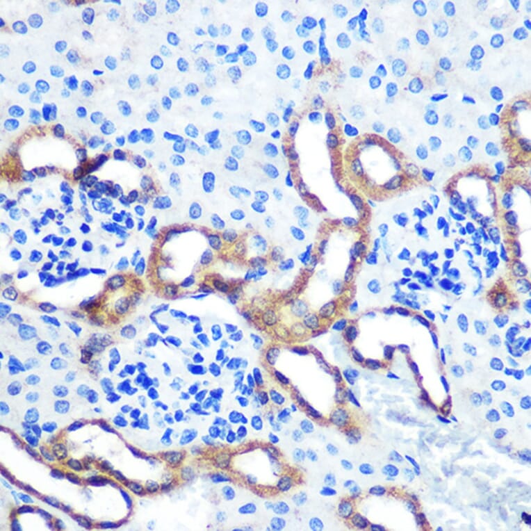 Immunohistochemistry - Anti-LRRK2 Antibody (A92628) - Antibodies.com