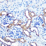 Immunohistochemistry - Anti-LRRK2 Antibody (A92628) - Antibodies.com