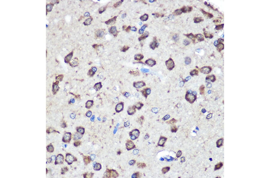 Immunohistochemistry - Anti-LRRK2 Antibody (A92628) - Antibodies.com