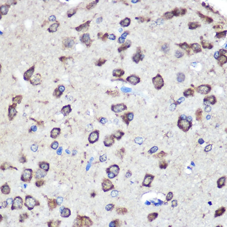 Immunohistochemistry - Anti-LRRK2 Antibody (A92628) - Antibodies.com