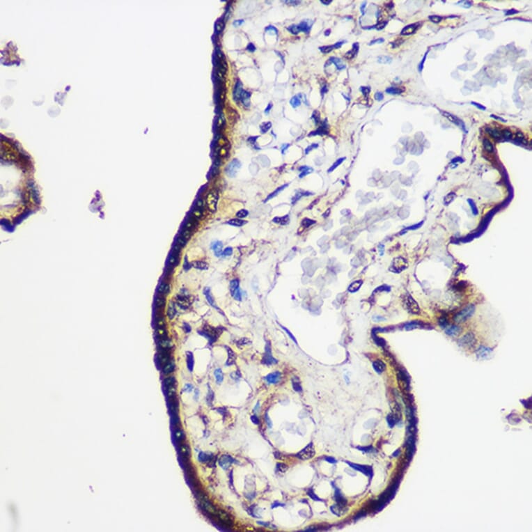 Immunohistochemistry - Anti-LRRK2 Antibody (A92628) - Antibodies.com