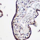 Immunohistochemistry - Anti-LRRK2 Antibody (A92628) - Antibodies.com