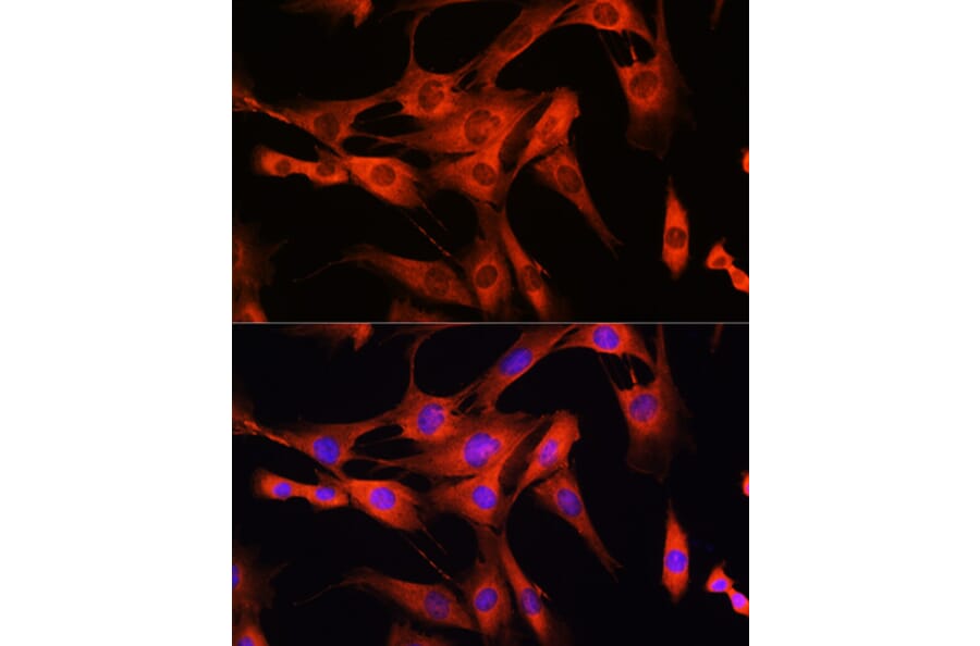 Immunofluorescence - Anti-LRRK2 Antibody (A92628) - Antibodies.com