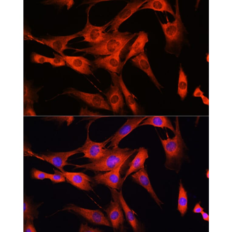 Immunofluorescence - Anti-LRRK2 Antibody (A92628) - Antibodies.com