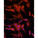 Immunofluorescence - Anti-LRRK2 Antibody (A92628) - Antibodies.com