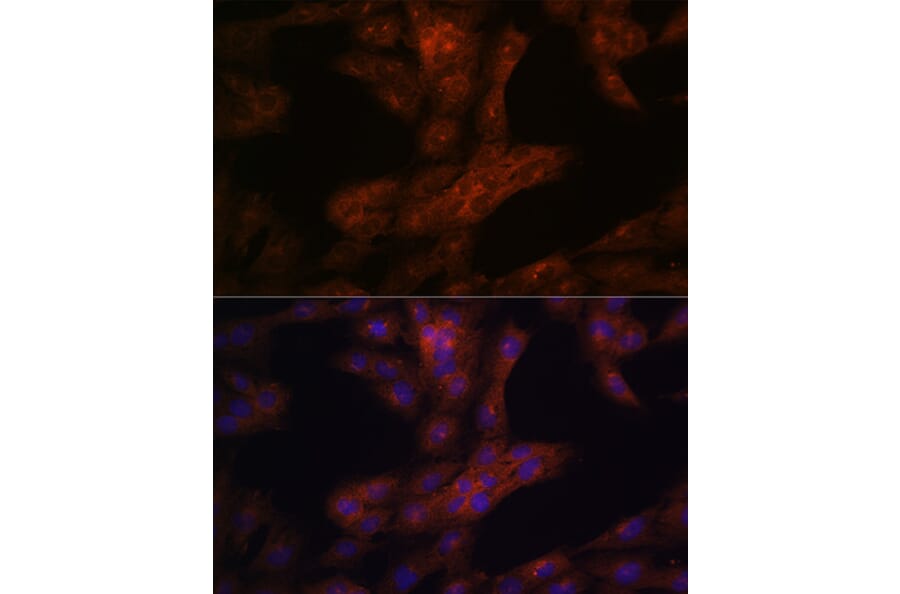 Immunofluorescence - Anti-LRRK2 Antibody (A92628) - Antibodies.com