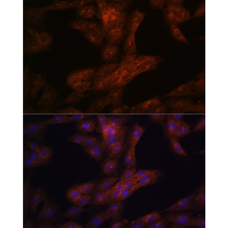 Immunofluorescence - Anti-LRRK2 Antibody (A92628) - Antibodies.com