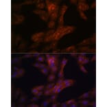 Immunofluorescence - Anti-LRRK2 Antibody (A92628) - Antibodies.com