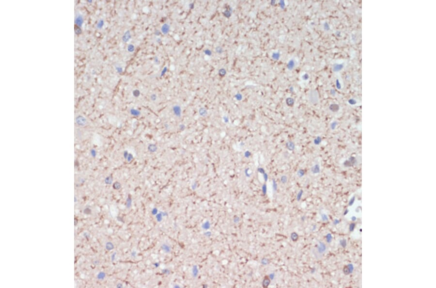 Immunohistochemistry - Anti-MAG/GMA Antibody (A92629) - Antibodies.com