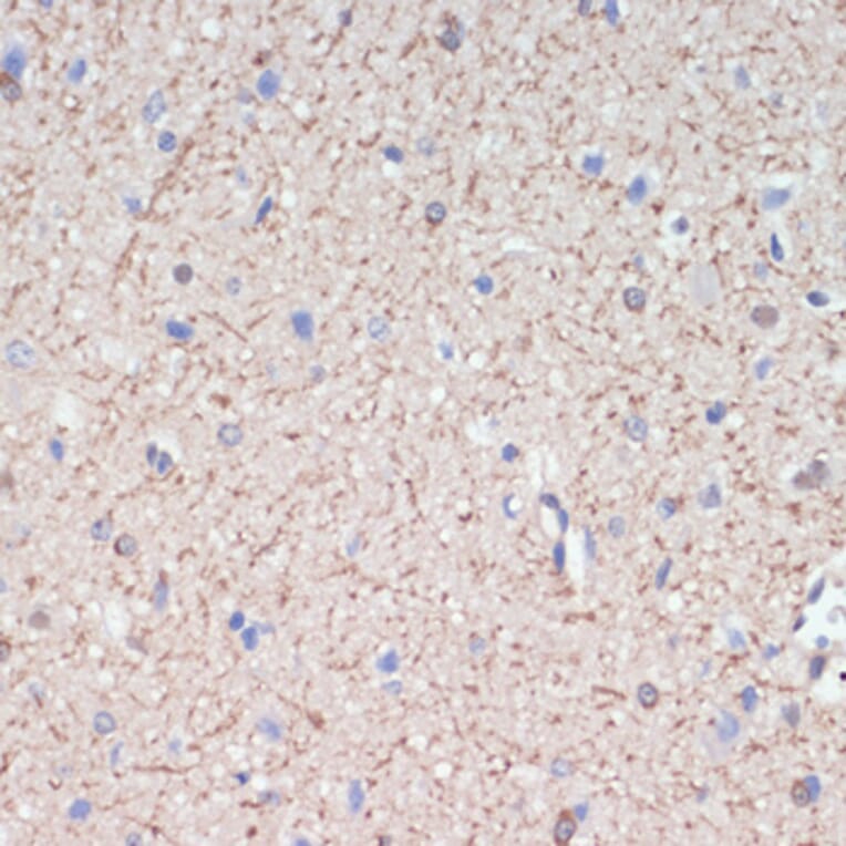 Immunohistochemistry - Anti-MAG/GMA Antibody (A92629) - Antibodies.com