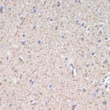 Immunohistochemistry - Anti-MAG/GMA Antibody (A92629) - Antibodies.com