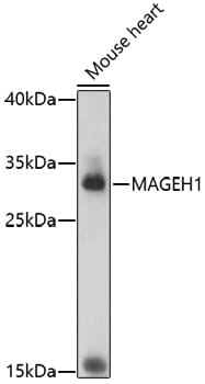 Western blot analysis of extracts of mouse heart, using Anti-MAGEH1 Antibody (A17143) at 1:1,000 dilution.
Secondary antibody: Goat Anti-Rabbit IgG (H+L) (HRP) (AS014) at 1:10,000 dilution.
Lysates / proteins: 25µg per lane.
Blocking buffer: 3% non-fat dry milk in TBST.
Detection: ECL Basic Kit (RM00020).
Exposure time: 180s.