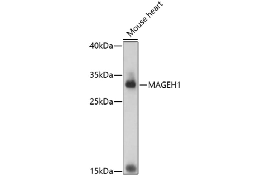 Western Blot - Anti-MAGEH1 Antibody (A92630) - Antibodies.com