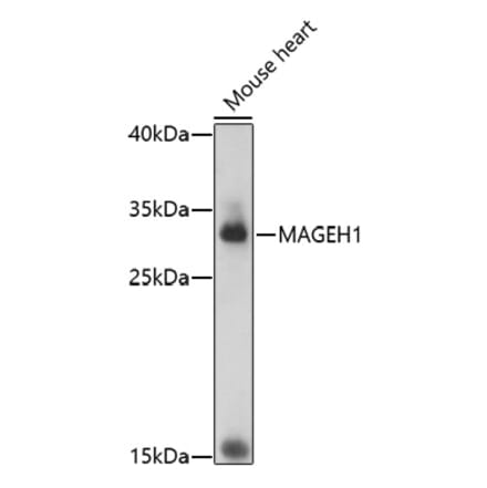 Western Blot - Anti-MAGEH1 Antibody (A92630) - Antibodies.com