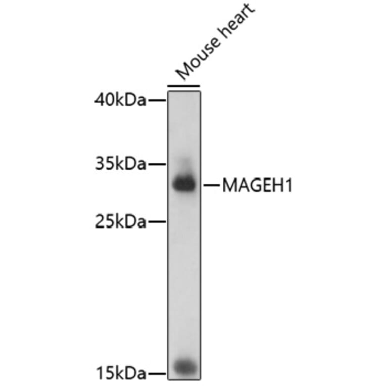 Western Blot - Anti-MAGEH1 Antibody (A92630) - Antibodies.com