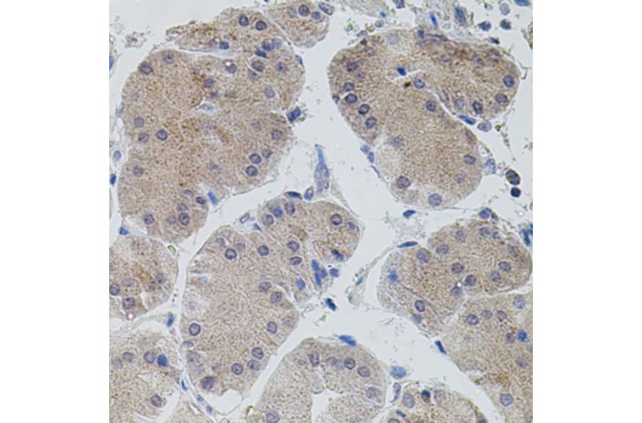 Immunohistochemistry - Anti-ASK1 Antibody (A3271) - Antibodies.com