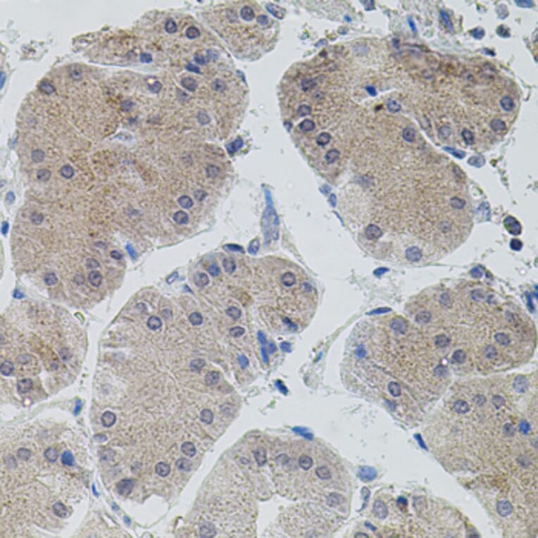 Immunohistochemistry - Anti-ASK1 Antibody (A3271) - Antibodies.com