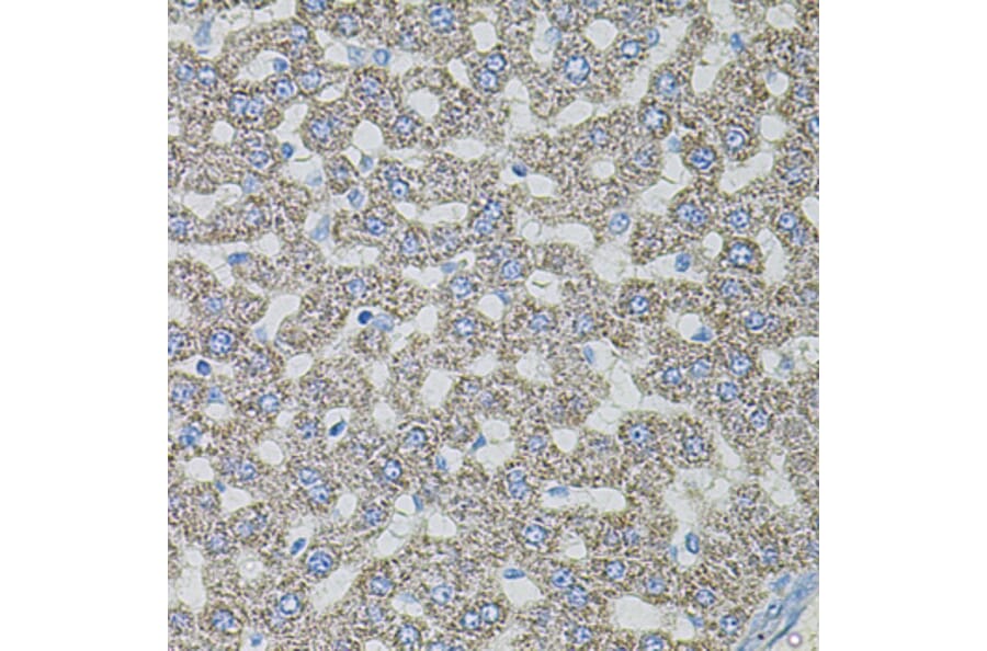 Immunohistochemistry - Anti-ASK1 Antibody (A3271) - Antibodies.com