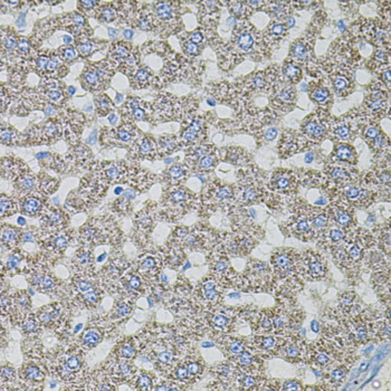 Immunohistochemistry - Anti-ASK1 Antibody (A3271) - Antibodies.com