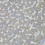 Immunohistochemistry - Anti-ASK1 Antibody (A3271) - Antibodies.com