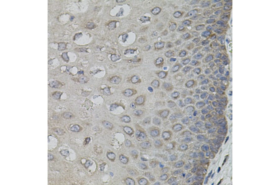 Immunohistochemistry - Anti-ASK1 Antibody (A3271) - Antibodies.com