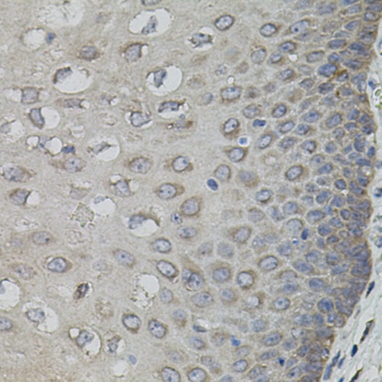 Immunohistochemistry - Anti-ASK1 Antibody (A3271) - Antibodies.com